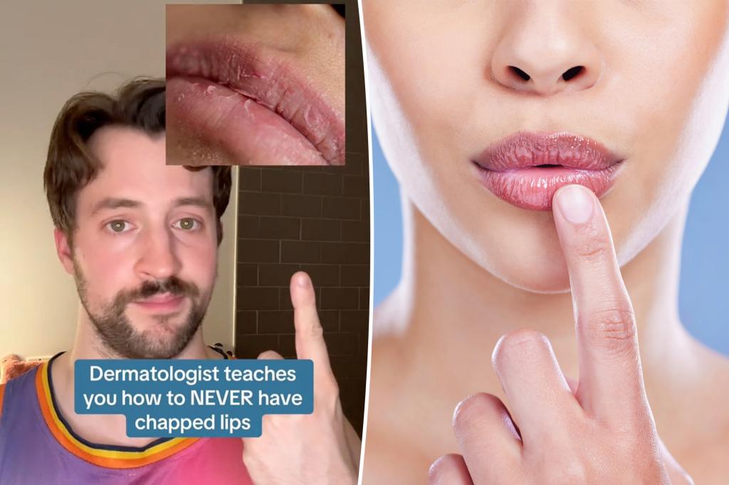 The dermatologist's 3 steps to get rid of chapped lips