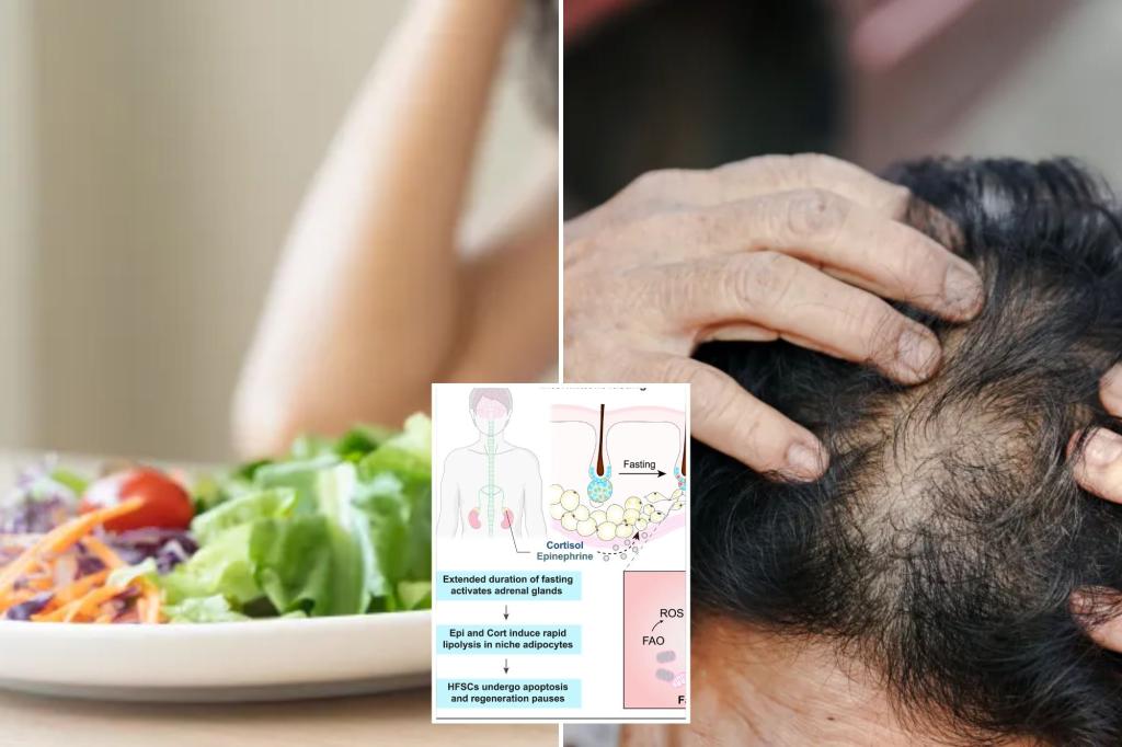 Popular diet may lead to loss of hair volume: new study